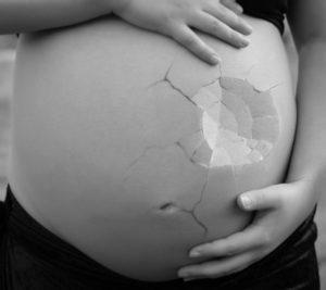 donna incinta aborto