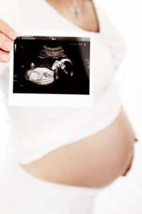 donna incinta ecografia