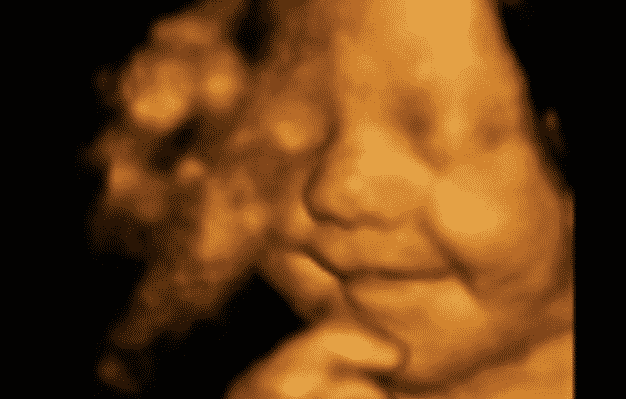 feto ultrasuoni