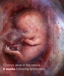 Embrione 8 settimane
