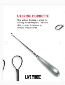 Curette uterina