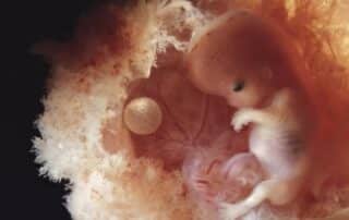 Embrione feto