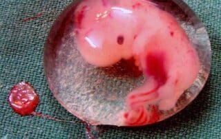 Embrione