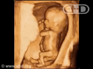 Video feto